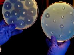 Antimicrobial resistance now a leading cause of death worldwide, study  finds | Antibiotics | The Guardian